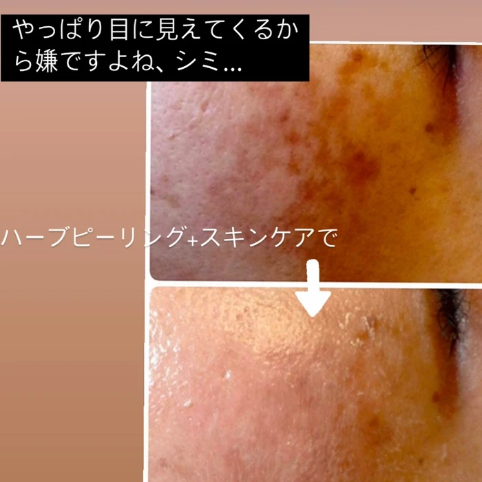 画像295