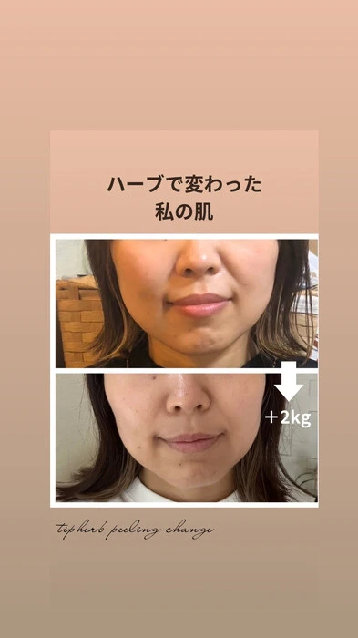 画像321