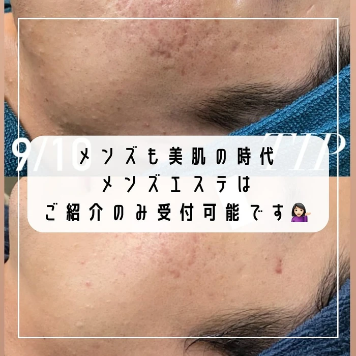 画像355