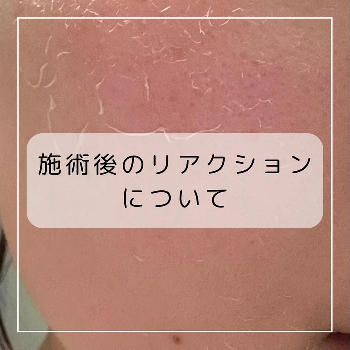 画像393