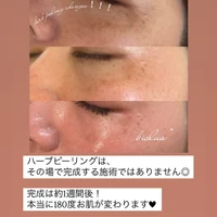 画像398