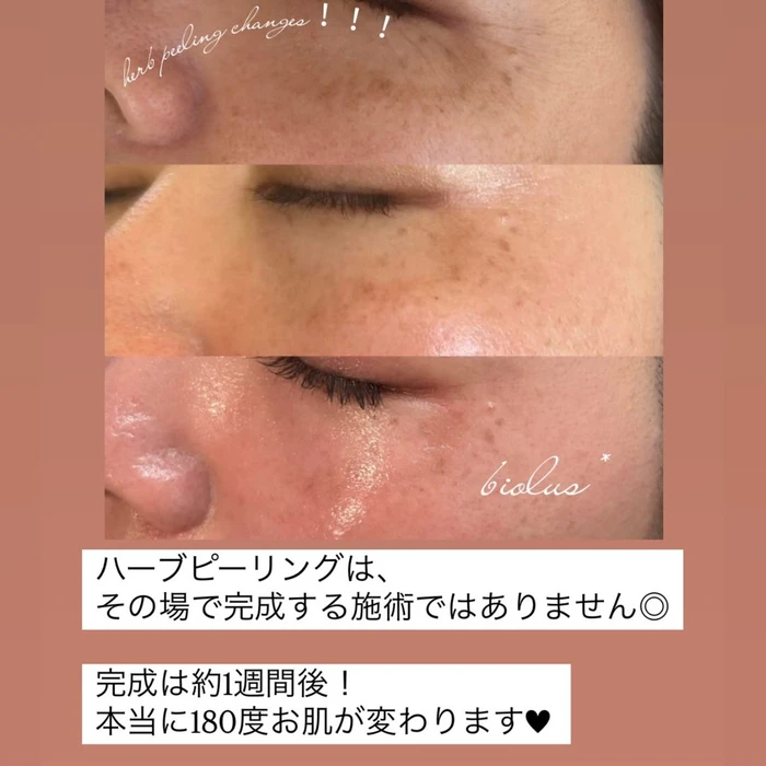 画像398